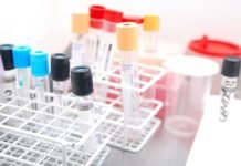 blood test