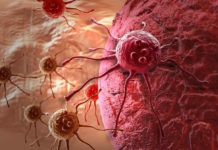 immunotherapy